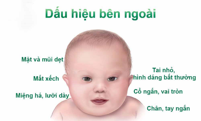 Trắc nghiệm đúng/sai